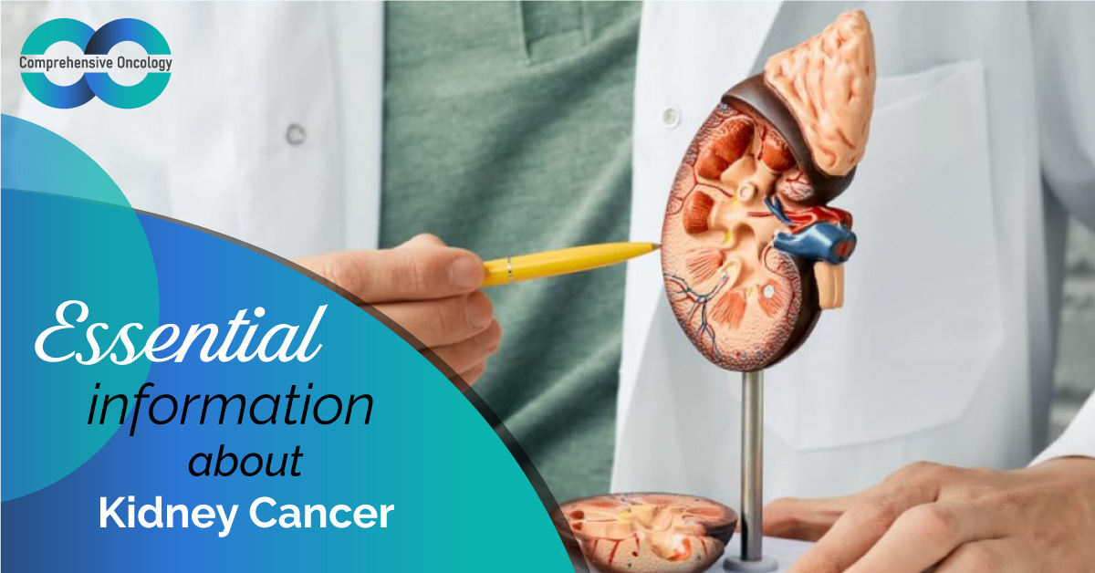 Essential Information About Kidney Cancer